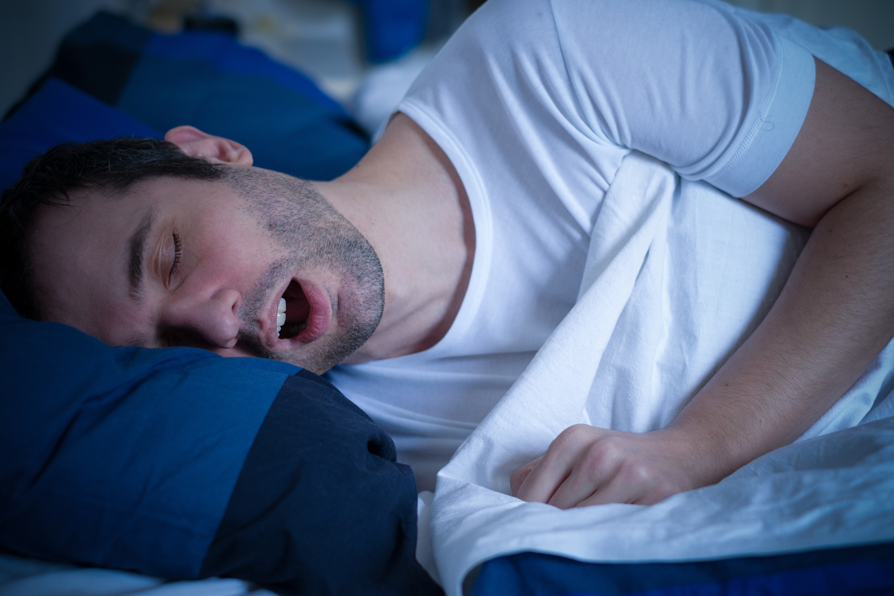 Obstructive Sleep Apnea